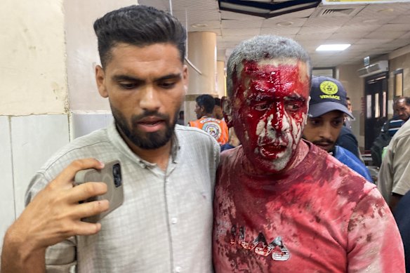 El fotoperiodista palestino herido Hatem Omar recibe ayuda después del ataque.
