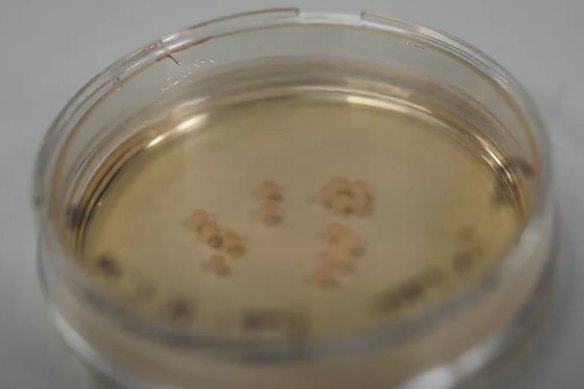 Los organoides cerebrales (versiones en miniatura 3D de los órganos) creados por científicos del Instituto Australiano de Bioingeniería y Nanotecnología de la Universidad de Queensland.